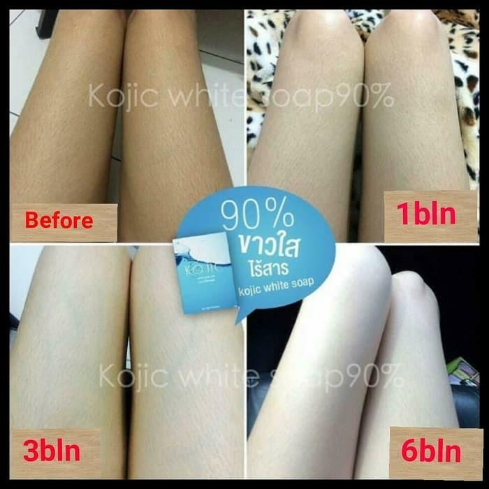 Kojic White Soap & Serum ORIGINAL Thailand 100% / WHITENING SOAP / SABUN PEMUTIH TUBUH THAILAND Kojic White Soap & Serum ORIGINAL Thailand 100% / WHITENING SOAP / SABUN PEMUTIH TUBUH THAILAND