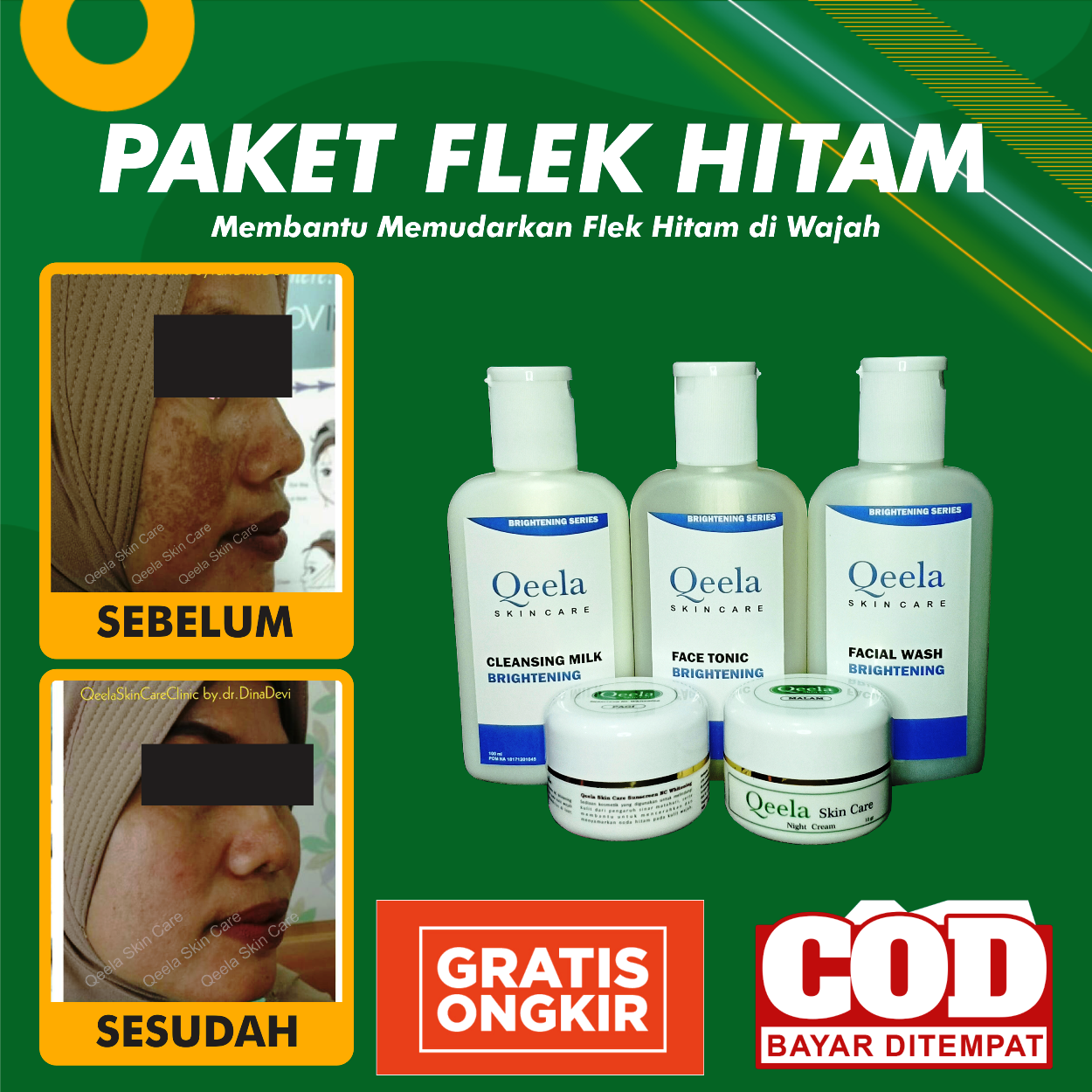 PAKET LENGKAP CREAM WAJAH FLEK HITAM / CREAM WAJAH MELASMA / KRIM PENGHILANG FLEK HITAM / KRIM WAJAH FLEK HITAM / KRIM WAJAH MELASMA / KRIM WAJAH AMAN BPOM PAKET LENGKAP CREAM WAJAH FLEK HITAM / CREAM WAJAH MELASMA / KRIM PENGHILANG FLEK HITAM / KRIM WAJAH FLEK HITAM / KRIM WAJAH MELASMA / KRIM WAJAH AMAN BPOM