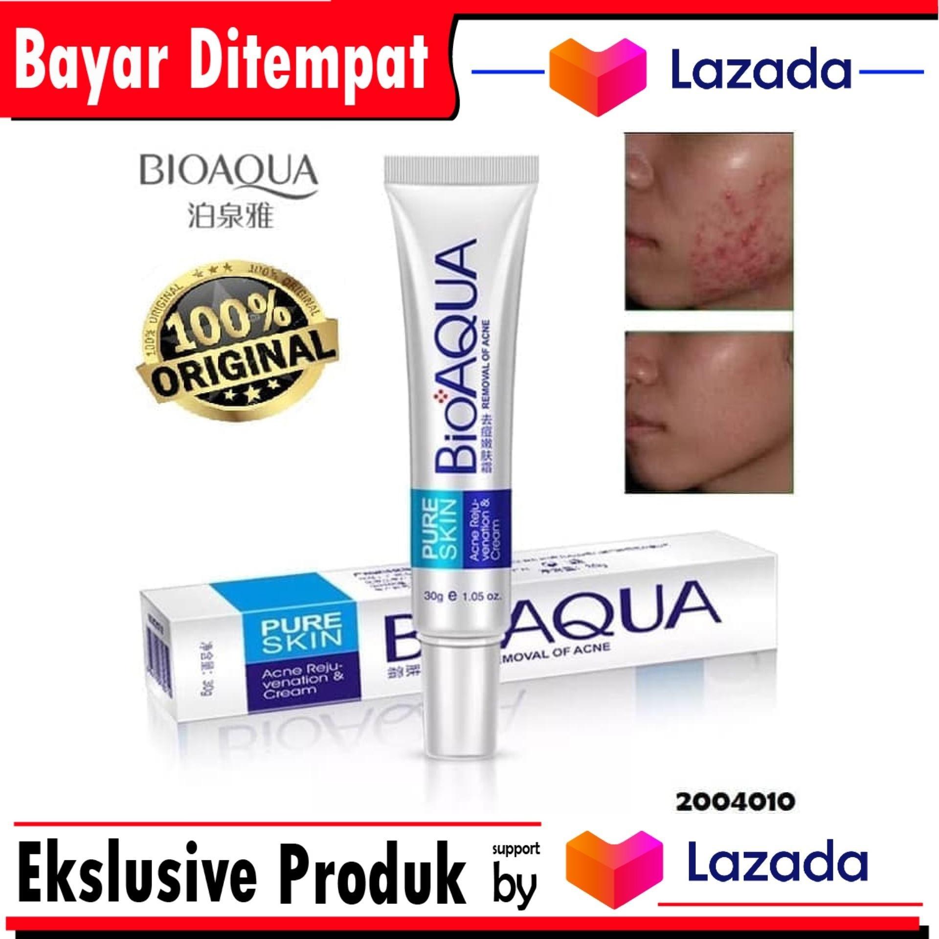 Bioaqua Anti Acne Anti Jerawat ASLI Original - Removal of Acne - Obat Ampuh Anti Jerawat - Obat Penghilang Jerawat BIOAQUA PURE SKIN REMOVAL OF ACNE Cream Anti JERAWAT Bioaqua Anti Acne Anti Jerawat ASLI Original - Removal of Acne - Obat Ampuh Anti Jerawat - Obat Penghilang Jerawat BIOAQUA PURE SKIN REMOVAL OF ACNE Cream Anti JERAWAT