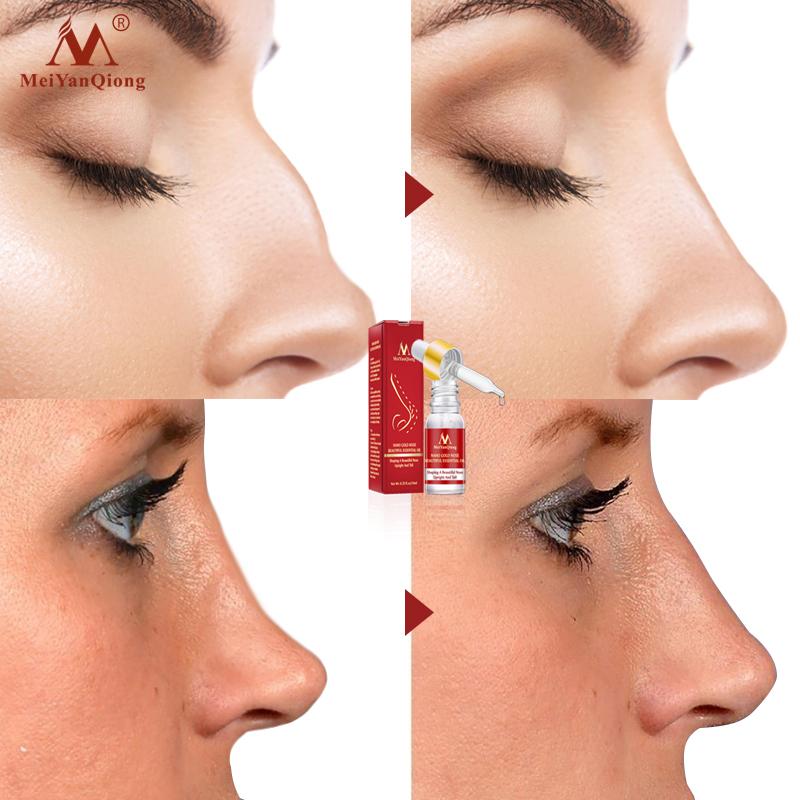 Laklaker Minyak Esensi Pemancung Hidung Minyak Emas Nano Pengangkat Pemancung Tulang Hidung 10Ml Laklaker Minyak Esensi Pemancung Hidung Minyak Emas Nano Pengangkat Pemancung Tulang Hidung 10Ml