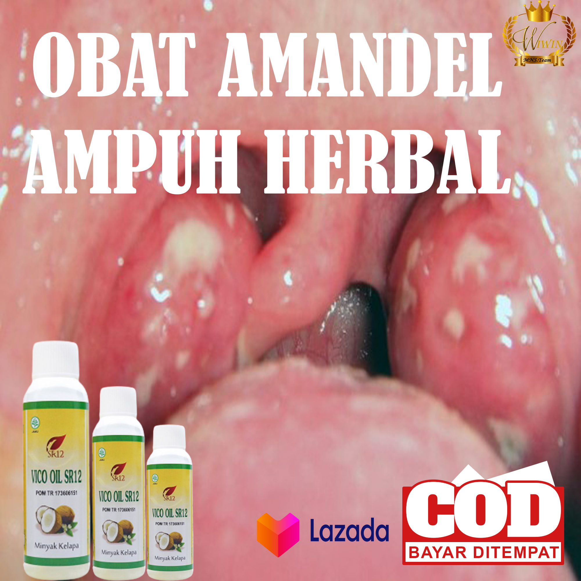 BETSELLER !! OBAT AMANDEL PALING AMPUH/ VCO OIL S12 ORIGINAL/ OBAT AMANDEL ANAK /OBAT AMANDEL DEWASA/ UNTUK SEMUA USIA HERBAL ORIGINAL BPOM BETSELLER !! OBAT AMANDEL PALING AMPUH/ VCO OIL S12 ORIGINAL/ OBAT AMANDEL ANAK /OBAT AMANDEL DEWASA/ UNTUK SEMUA USIA HERBAL ORIGINAL BPOM