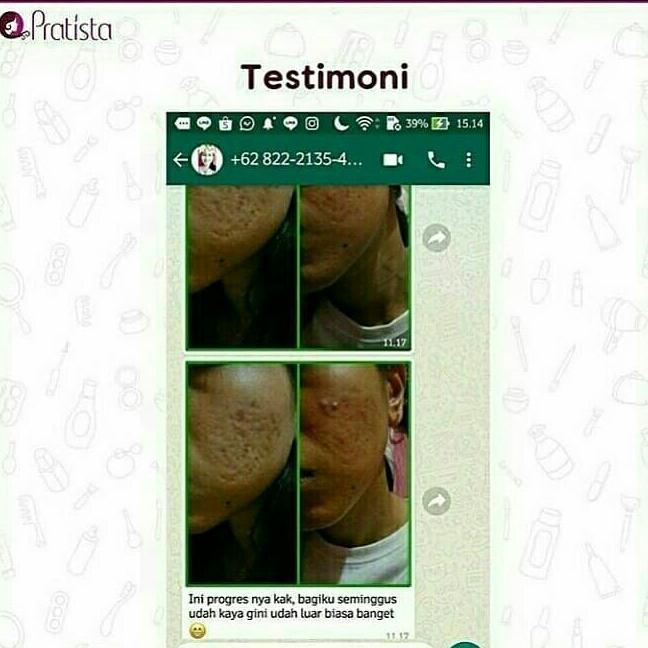 Detail Gambar Paket 2in1 pria wanita Cream pagi/malam Penghilang bopeng/scar bekas jerawat