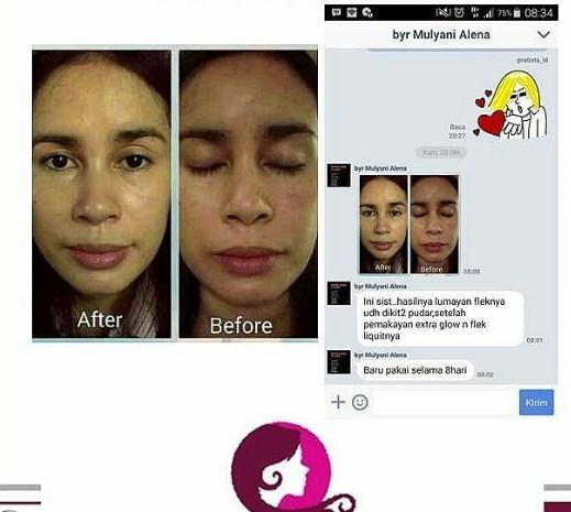 ... Cream Penghilang Flek Hitam / Penghilang Flek Hitam Di Wajah/ Menghilangkan Flek Hitam Bekas Jerawat ...