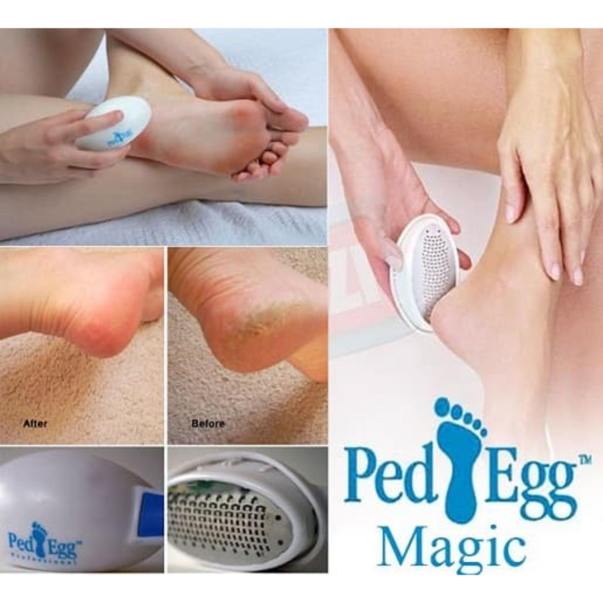 Queen Mall - Ped Egg - Penghalus Tumit Kaki Pembersih Tumit Kaki Alat .