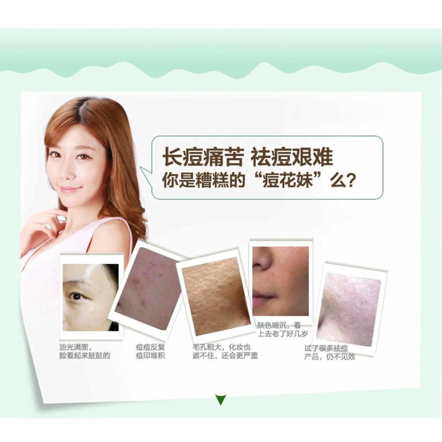 Bioaqua Cream Masker Wajah Aloe Vera 92% Lidah Buaya S2607- 220g Januari 2019 - 5 Bioaqua Cream Masker Wajah Aloe Vera 92% Lidah Buaya s2607- 220g - 5