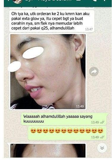 ... Cream Penghilang Flek Hitam / Penghilang Flek Hitam Di Wajah/ Menghilangkan Flek Hitam Bekas Jerawat ...