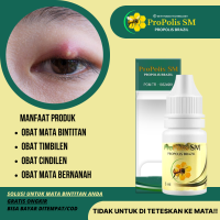 Obat Bintitan mata atas Timbilen Cindilen Kantung Mata Hitam obat bintitan di kaki obat bintitan di bawah mata  Infeksi Iritasi Mata Mata Perih Obat Oles Benjolan Di Bawah Mata  obat bintik di wajah Dengan Propolis SM Brazilian