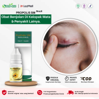 Obat Oles Penghilang Benjolan di Kelopak Mata Salep Pengempis Mata Bintitan Herbal Alami