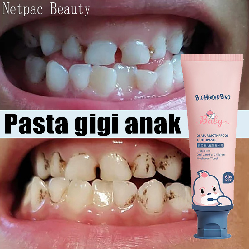 NetPac Pasta Gigi Anak Pemutih Gigi Perontok Kids Toothpaste Karang Gigi Pembersih Karang Gigi Kerusakan Gigi Fluorine Rendah Anti Karies Pasta Gigi Pure kids Toothpaste 60g