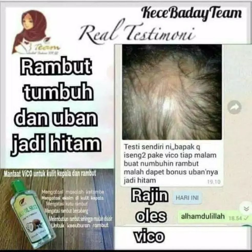 MINYAK RAMBUT PENGHILANG UBAN - OBAT PENGHILANG UBAN - OBAT RAMBUT BERUBAN - MENGHILANGKAN UBAN minyak rambut penghilang uban – obat penghilang uban – obat rambut beruban – menghilangkan uban