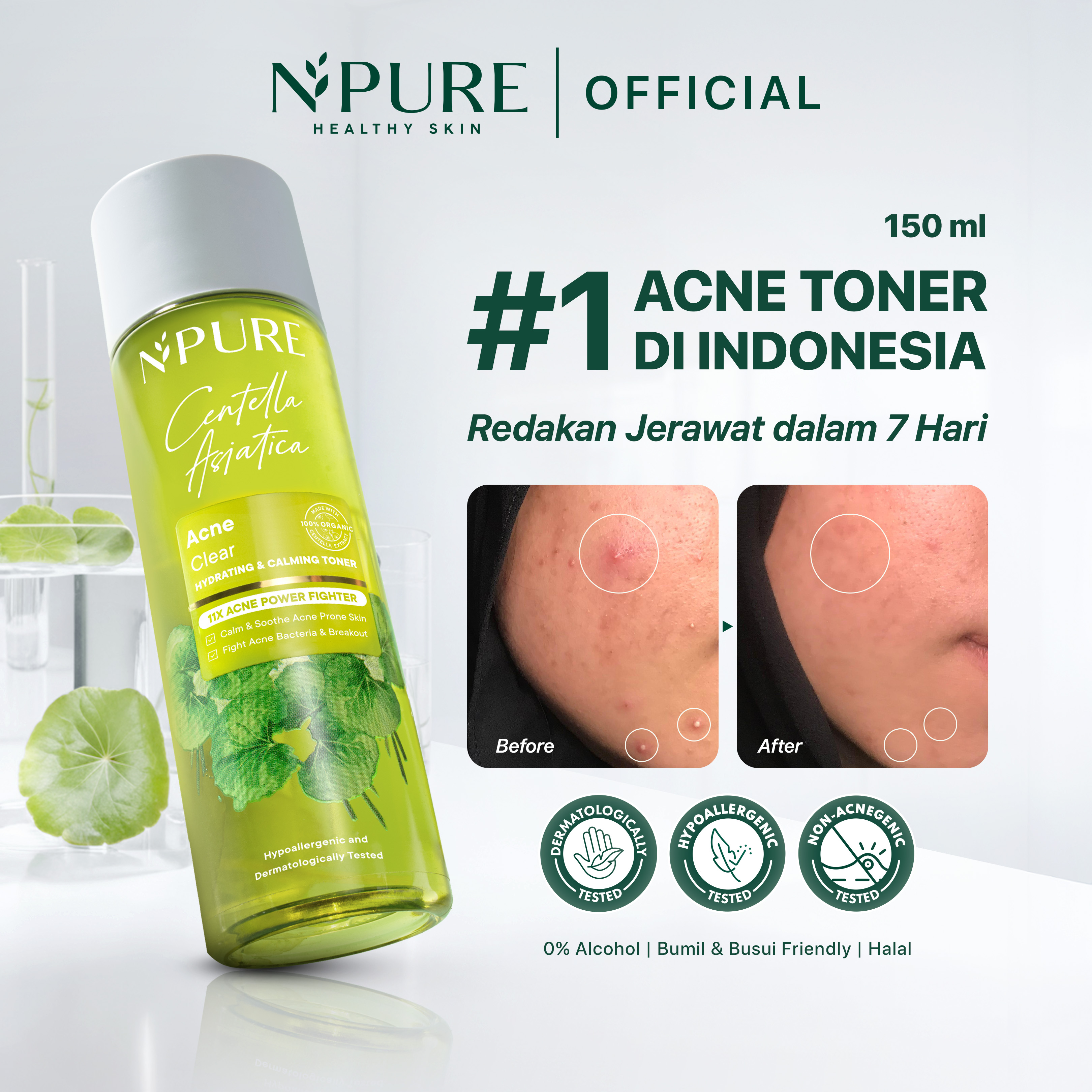 NPURE Cica (Centella) Acne Clear Hydrating Toner / Anti Acne / Jerawat / Kulit Kemerahan / Berunt...