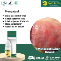 Obat Luka Lecet di Kepala Penis Obat Balanitis Obat Infeksi Jamur Kelamin Obat Penis Gatal Obat Herpes Kelamin Obat Jerawat Kelamin Obat Gatal Buah Zakar Pria dengan Propolis SM