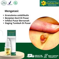 Obat Granuloma umbilikalis Obat Benjolan Kecil Di Pusar Obat Daging Tumbuh Di Pusar Obat Infeksi Pusar Bernanah Obat Puser Bayi Selalu Keluar Air Obat Tetes Herbal Propolis SM