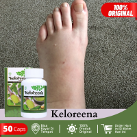 Obat Kaki Bengkak Pengempis Kaki Bengkak Kaki Bengkak Karena Asam Urat Diabetes Jantung Ginjal Kaki Bengkak Karena Jatuh Kaki Keseleo Kaki Memar Kaki Bengkak Ibu Hamil Edema Kaki Kaki Bengkak dan Nyeri Sakit Telapak Kaki Dengan Keloreena