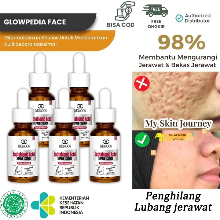 Serum Jerawat Dan Bekas Jerawat Serum Bopeng 30ml Penghilang bekas jerawat hitam dan serum pengec...