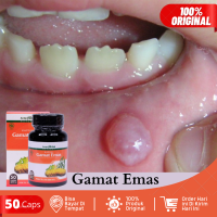 Obat Benjolan Di Mulut & Lidah Benjolan Di Bibir Mucocele Benjolan Kelenjar Mukokel Benjolan Bibir Bagian Dalam Benjolan Yang Membesar Di Bibir Kelenjar Air Liur Penghilang Benjolan Mucocele Benjolan Di Lidah Dengan Kapsul Gamat Emas