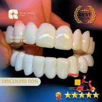 ( Lengkap ) GIGI PALSU Original Snap On Smile 1 Set Atas Bawah