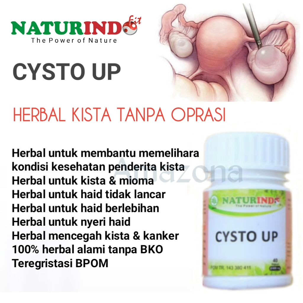 Obat herbal kista myoma Cysto Up Naturindo obat herbal cysto up naturindo (spesial myom & kista)